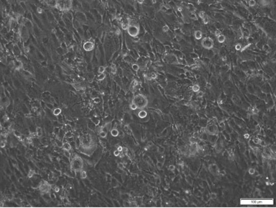 3D hBMVEC on a collagene extracellular matrix