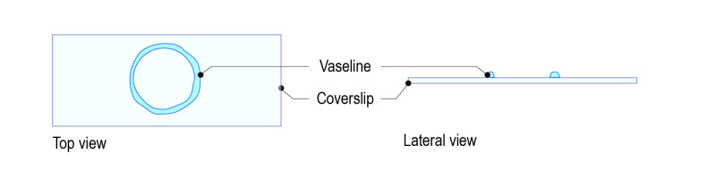 Hanging-drop-protocol-for-C.-elegans_Fig_All-01-e1530794234483