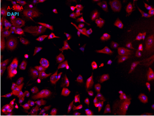 pericytes immortalized cell lines