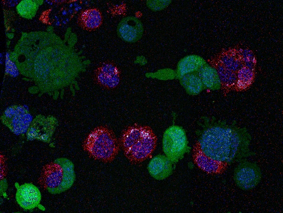 Figure 1: Highly metastatic mouse cancer cells under mechanical confinement. Credit: Chiara Cannatá, IMIM & Fabio Pezzano, CRG