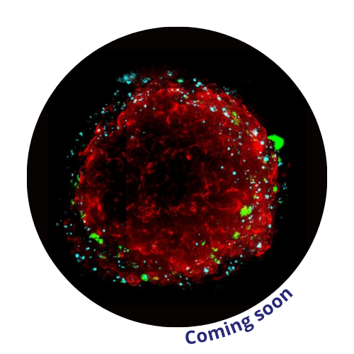 lung-spheroid-cherrybiotech
