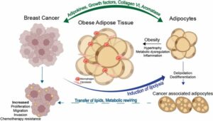 Schematic of adipose tissue–breast cancer crosstalk: obese adipose tissue secretes adipokines and lipids, drives cancer cell growth and therapy resistance, and forms CAAs.