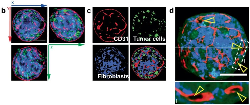 Confocal and light-sheet fluorescence microscopy images showing vascularized breast cancer spheroids (VTS). Panel b: 3D reconstructions of spheroids containing tumor cells (green), fibroblasts (blue), and endothelial cells (red, CD31+), viewed along different axes (x, y, z). Panel c: Segmented images showing separated compartments: endothelial cells forming pseudovessels (CD31, red), tumor cells (green), fibroblasts (blue), and merged composite. Panel d: High-magnification view highlighting pseudovessel structures with lumen formation (yellow arrowheads) inside the spheroid, indicating organized vascular-like networks.
