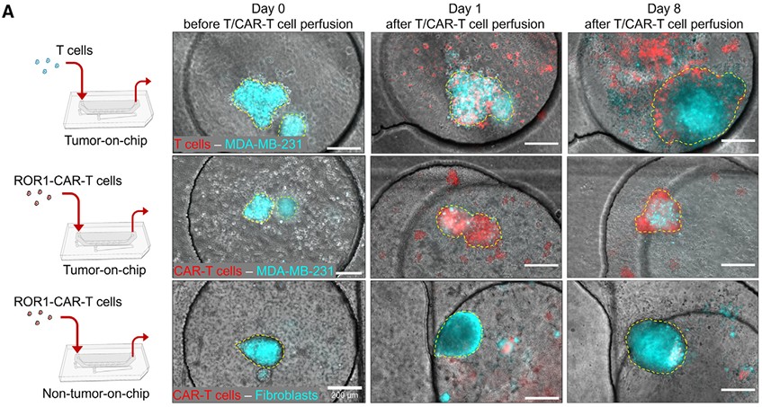 Fluorescent microscopy images showing breast cancer-on-chip experiments with control T cells or ROR1-CAR-T cells. Tumor aggregates from MDA-MB-231 breast cancer cells (cyan) or fibroblast spheroids (cyan) are cultured in chip chambers. Control T cells or CAR-T cells (red) are perfused through the vasculature-like channel. Images taken at day 0, day 1, and day 8 show that CAR-T cells specifically infiltrate and reduce MDA-MB-231 tumor aggregates, whereas control T cells are excluded. In contrast, CAR-T cells do not significantly infiltrate fibroblast spheroids, demonstrating target specificity. Yellow dashed lines mark tumor or spheroid boundaries; scale bars are 200 µm.