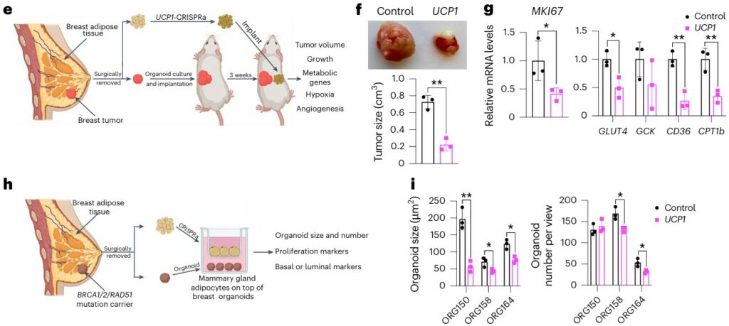 Schematic diagrams, tumor images, and bar graphs showing how engineered adipose organoids suppress tumor growth in breast cancer models. Panel e: Workflow: breast adipose tissue is resected, organoids are generated and engineered with CRISPRa to upregulate UCP1, then implanted near breast tumors in mice. After 3 weeks, tumors are analyzed for volume, growth, metabolic genes, hypoxia, and angiogenesis. Panel f: Representative tumor images and size measurements showing significantly smaller tumors in UCP1-organoid–treated mice compared to controls. Panel g: Bar graphs showing reduced expression of proliferation marker MKI67 and metabolic genes (GLUT4, GCK, CD36, CPT1b) in UCP1-treated tumors. Panel h: Schematic of organoid experiments with adipose tissue from BRCA1/2 or RAD51 mutation carriers, where CRISPRa-modulated mammary adipocytes are cultured on breast organoids. Panel i: Graphs showing reduced organoid size and number in UCP1-modulated conditions compared with controls across multiple patient-derived breast organoid lines.
