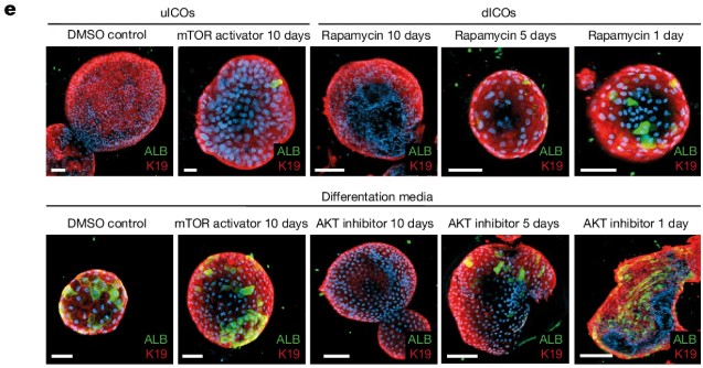 Fluorescence microscopy images of intrahepatic cholangiocyte organoids (ICOs) under different differentiation and signaling conditions. Staining shows albumin (ALB, green) and cytokeratin 19 (K19, red), marking hepatocyte and cholangiocyte lineages, respectively. Treatments with mTOR activator, rapamycin, and AKT inhibitor alter the balance of ALB⁺ and K19⁺ cells, revealing lineage plasticity and transdifferentiation potential in cholangiocyte-derived organoids.