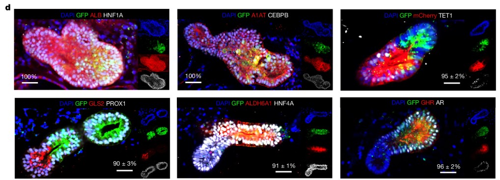 Fluorescence microscopy images of multi-zonal human liver organoids showing expression of zone-specific hepatocyte markers. Staining highlights hepatocyte nuclear factor 1A (HNF1A), alpha-1-antitrypsin (A1AT), CEBPB, TET1, GLS2, PROX1, ALDH6A1, HNF4A, growth hormone receptor (GHR), and androgen receptor (AR). Each panel demonstrates distinct expression domains corresponding to periportal or pericentral identity, confirming zonation within fused liver organoids.