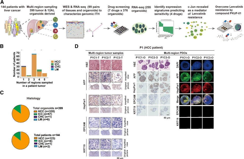Composite figure summarizing the establishment and use of a liver cancer organoid biobank. (A) Schematic workflow showing patient enrollment, multi-region tumor sampling, organoid derivation, sequencing, drug screening, and discovery of c-Jun–mediated lenvatinib resistance. (B) Bar chart of number of tumor regions sampled per patient. (C) Pie charts showing distribution of organoids and patients by cancer type (HCC, ICC, CHC, LM). (D) Histology and immunofluorescence panels comparing multi-region patient tumor samples and matched patient-derived organoids, stained with H&E, AFP, HepPar1, EpCAM, and KRT19, confirming preservation of tumor heterogeneity.