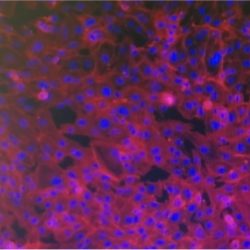 Blood brain barrier Blood brain barrier