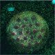 Breast-cancer-tumoroids-3d-invitro-cherrybiotech