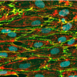 Differentiated Endothelium Differentiated Endothelium