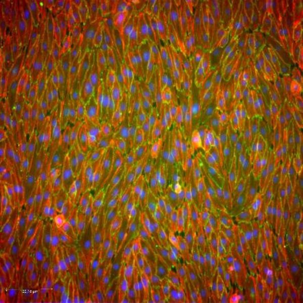 Confluent human endothelial cells in culture visualized by multi-colour immunofluorescence. Nuclei are counter-stained with DAPI (blue), filamentous actin is labelled with phalloidin (red), and the junctional protein VE-cadherin is immunolabelled (green), revealing the elongated, spindle-shaped morphology and the continuous cell–cell borders typical of an intact endothelial monolayer. Scale bar ≈ 100 µm.