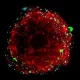 Organoid_CB_SSP.png