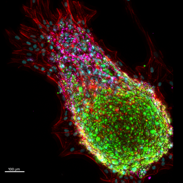 adipose-tissue-3d-cell-culture-CherryBiotech