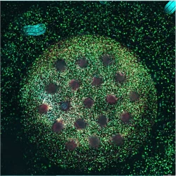 Cherry Biotech Breast cancer 3d cell culture model